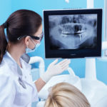Signature Smiles-Kenyon Oyler DDS-Meridian Dentist-x rays